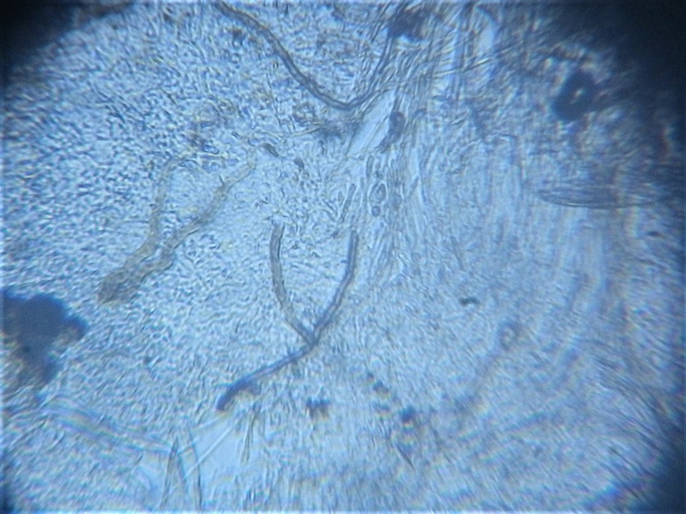 Pseudoplectania ericae image