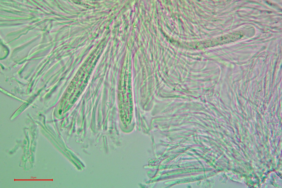 Bacidia laurocerasi subsp. idahoensis image