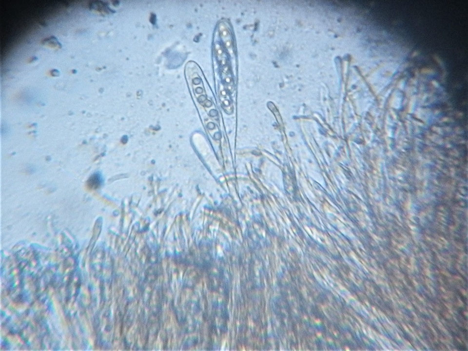 Octospora coccinea image