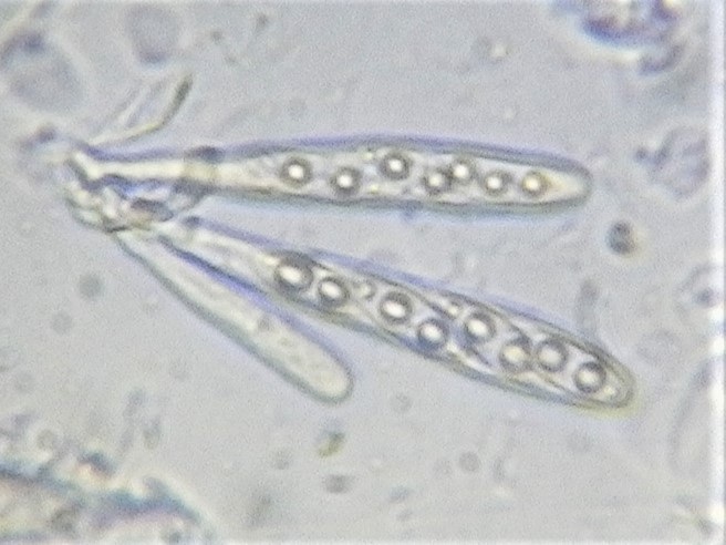 Octospora coccinea var. tetraspora image