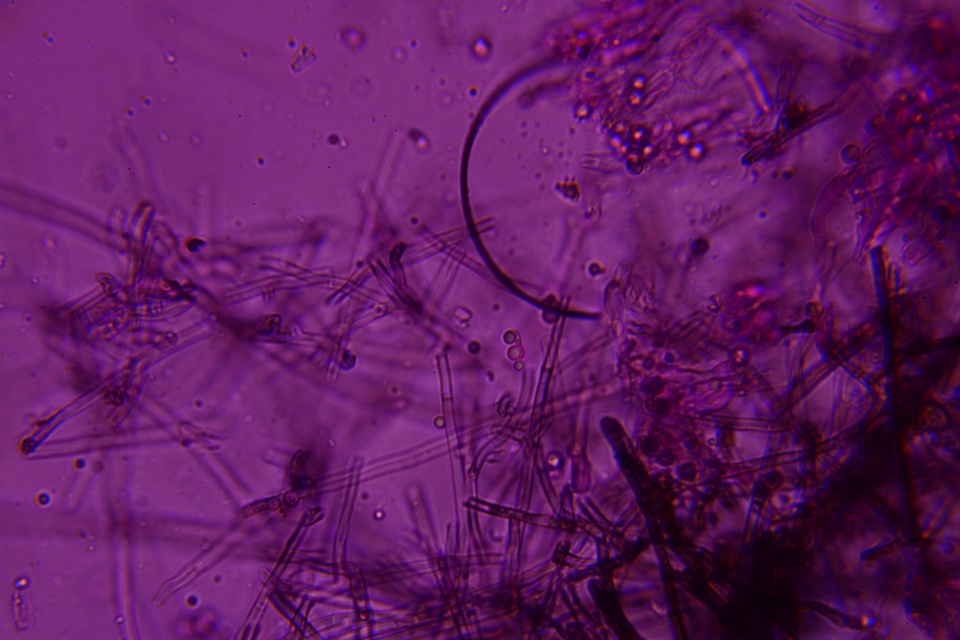 Byssocorticium caeruleum image