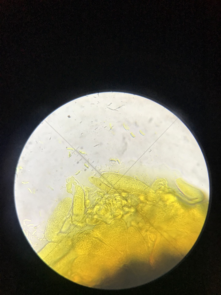 Nitschkia broomeana image