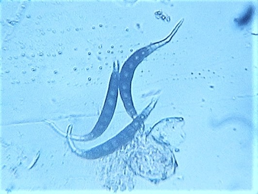 Scolicosporium fagi image
