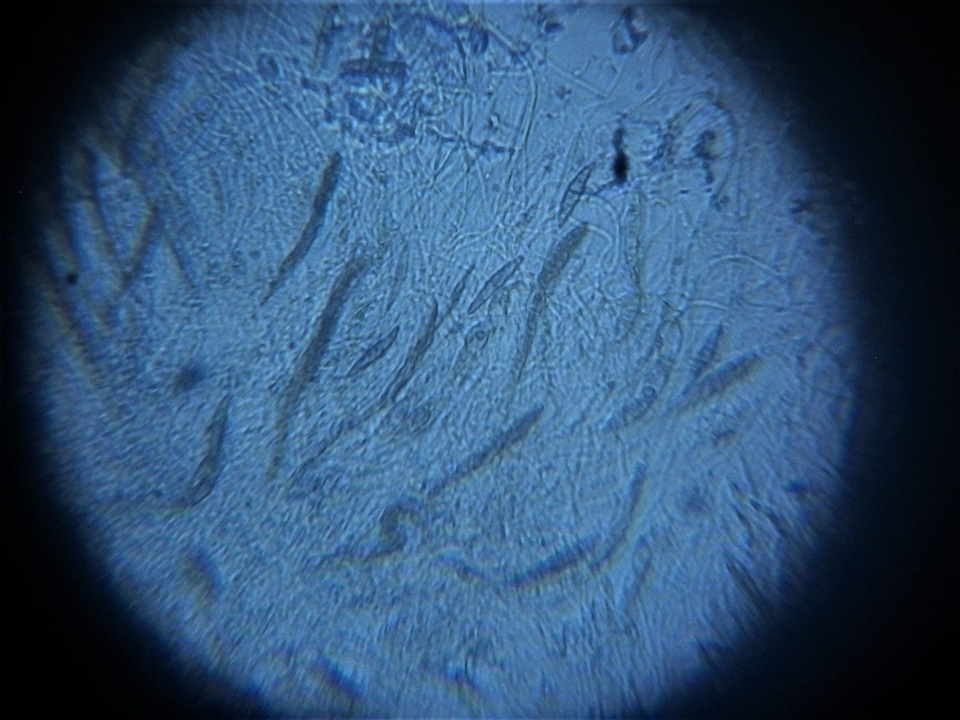 Byssosphaeria schiedermayeriana image