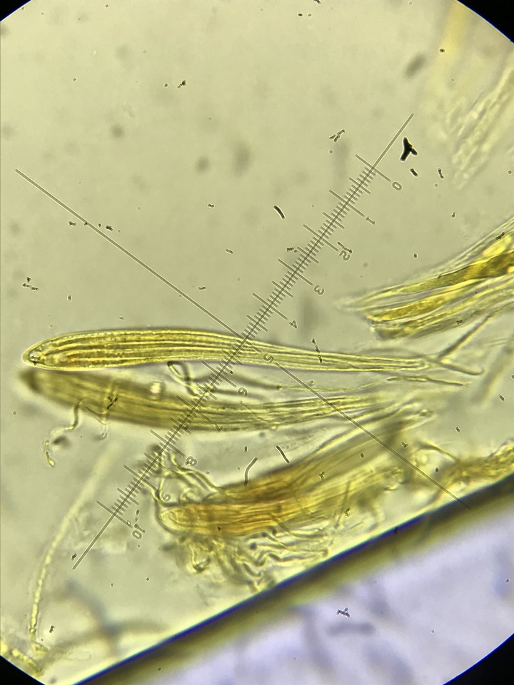 Coccomyces triangularis image