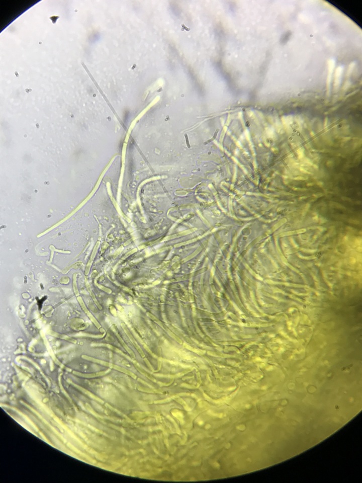 Coccomyces triangularis image