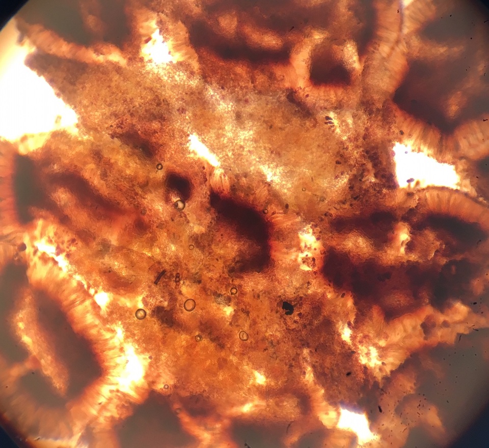 Dactylospora image