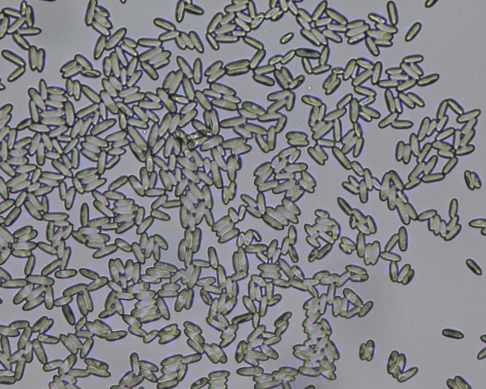 Parascedosporium putredinis image