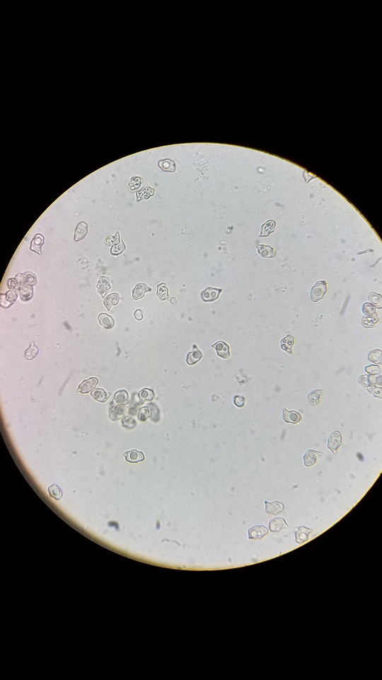 Nolanea cetrata f. minimospora image