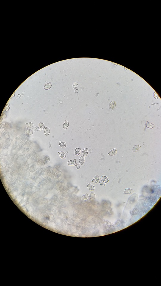 Nolanea cetrata f. minimospora image