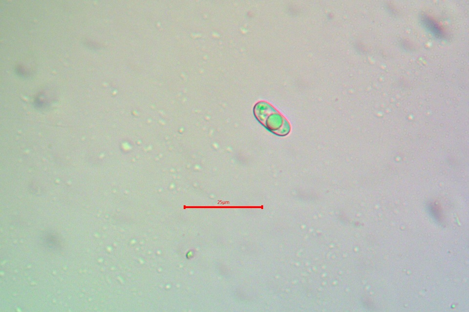Candelariella antennaria image