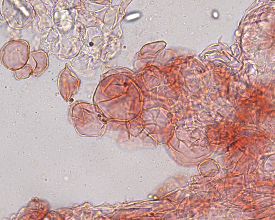 Ascobolus crenulatus image