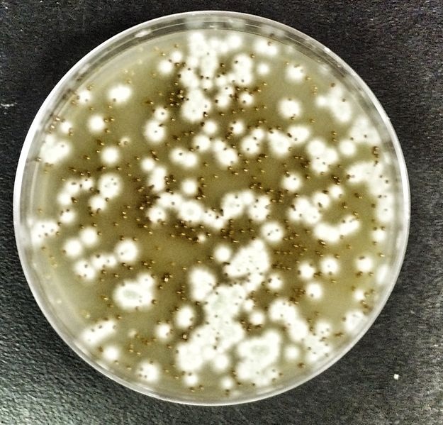 Cryptococcus gattii image