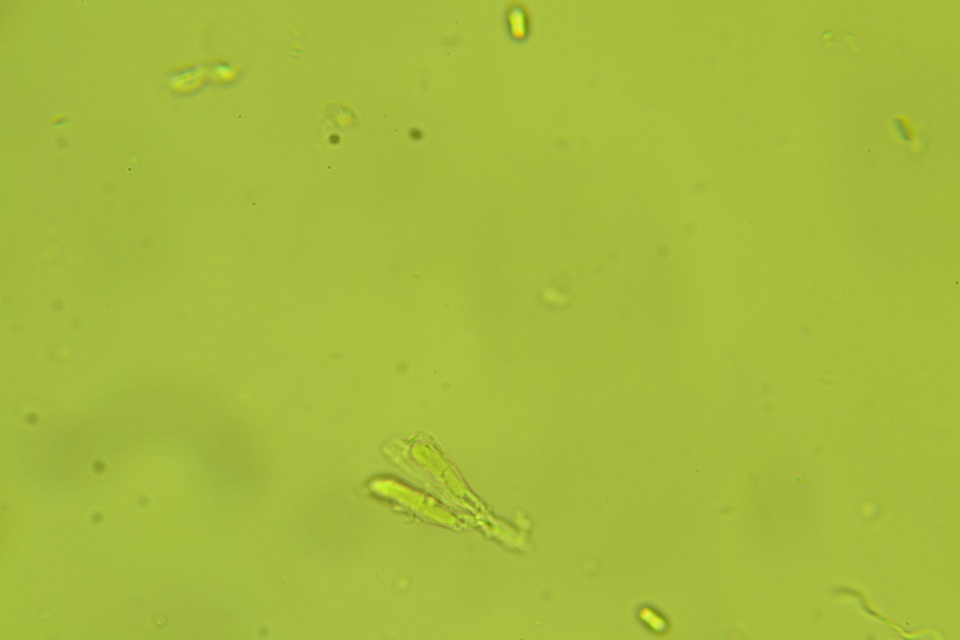 Repetobasidium macrosporum image
