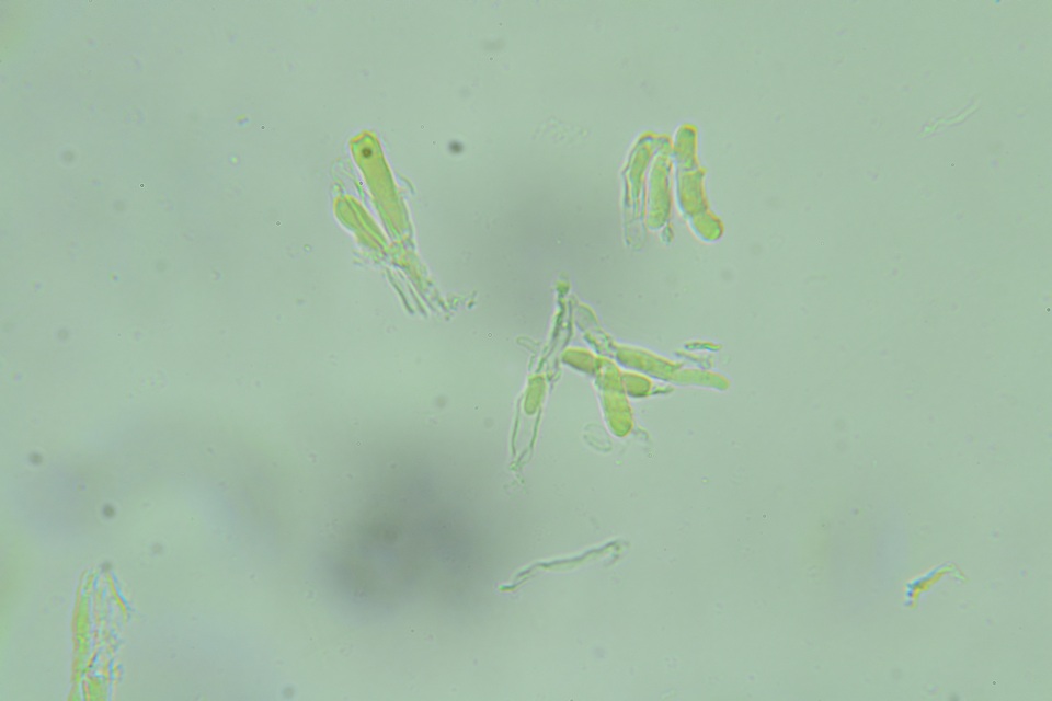 Repetobasidium macrosporum image