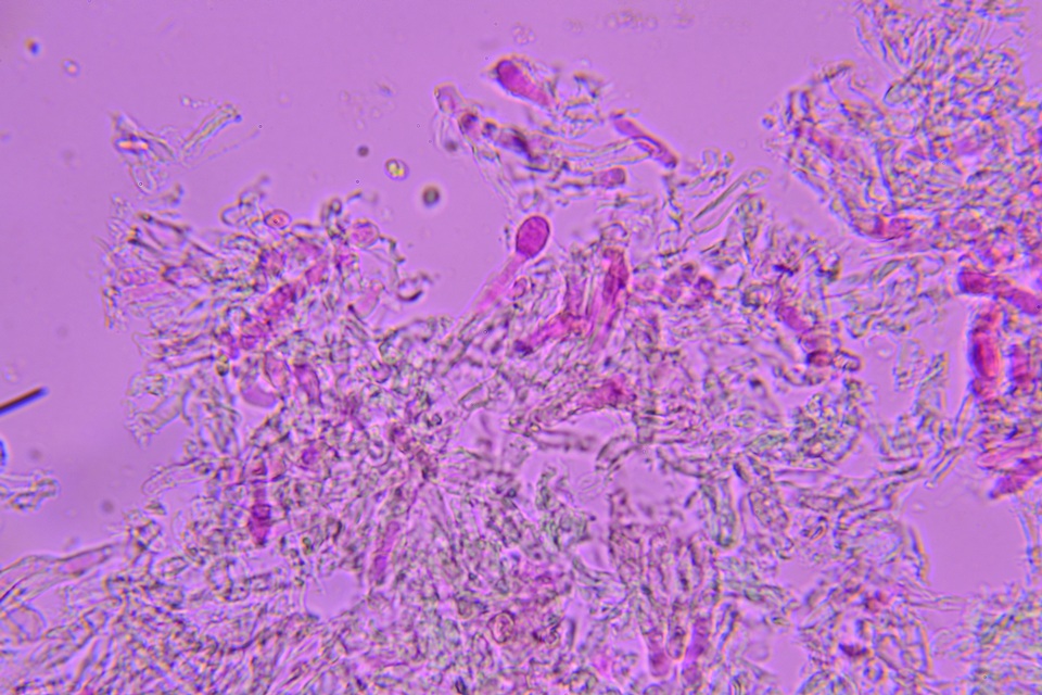 Repetobasidium macrosporum image