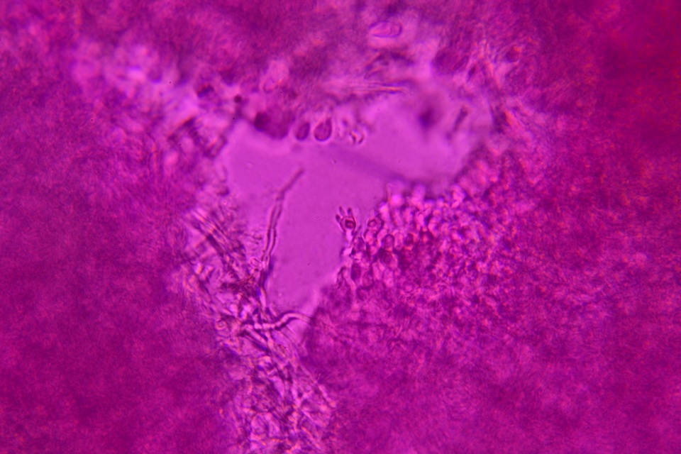 Protomerulius caryae image