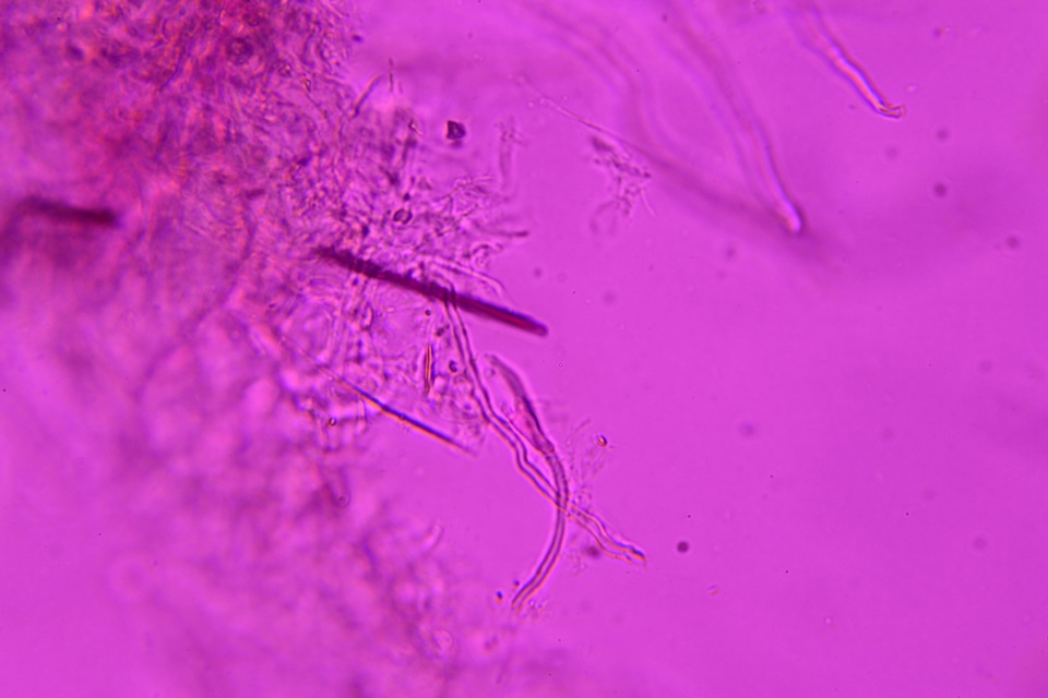 Protomerulius caryae image