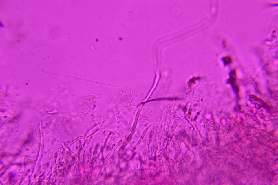 Protomerulius caryae image
