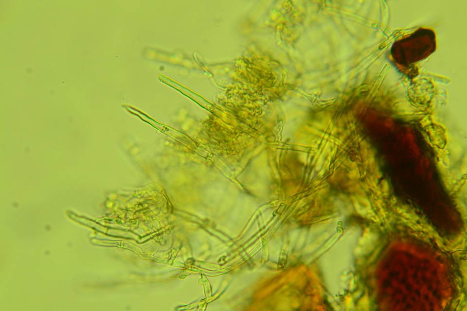 Amphinema byssoides image