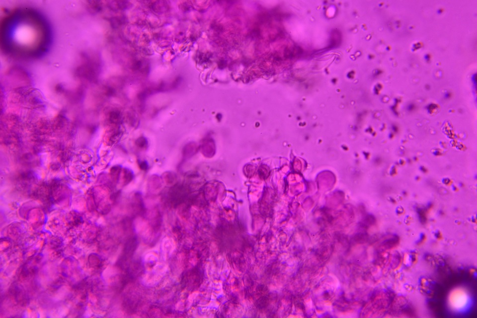 Tulasnella violea image