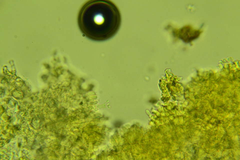 Sistotremastrum suecicum image