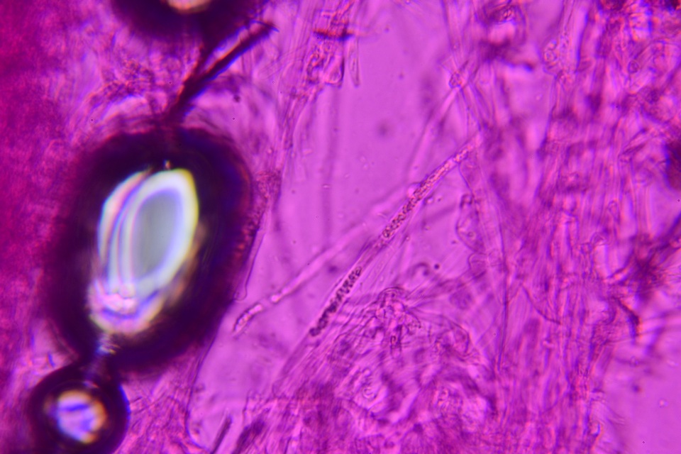 Sistotrema muscicola image