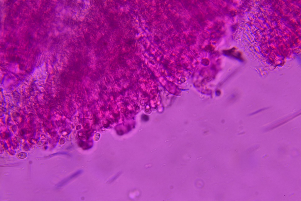 Podoscypha thozetii image