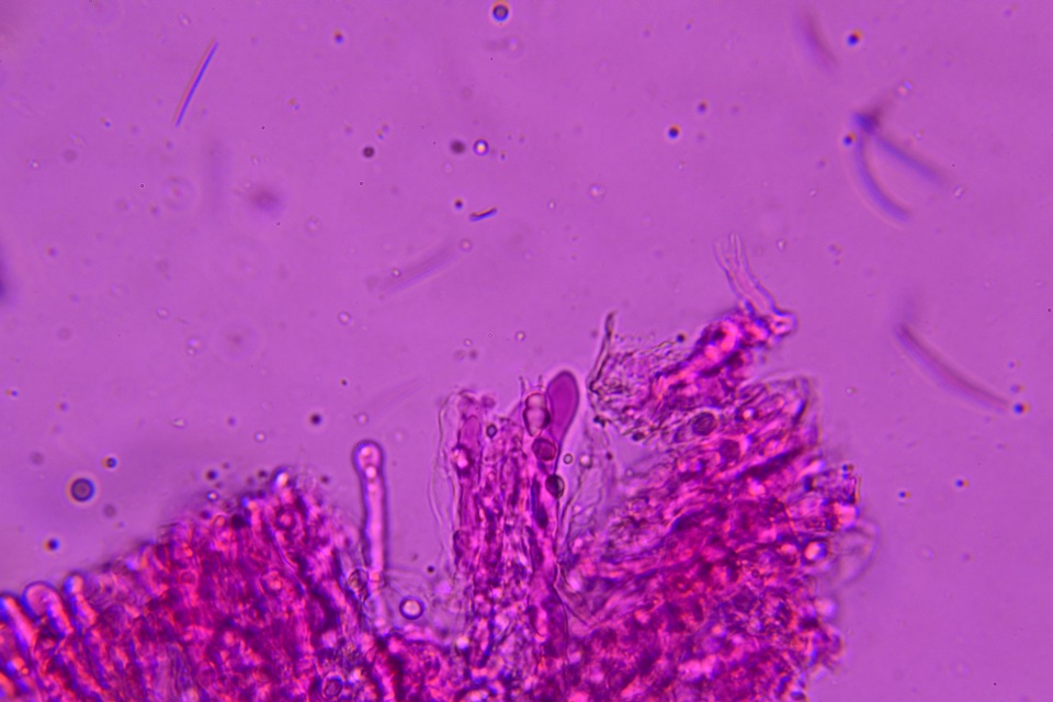 Podoscypha thozetii image