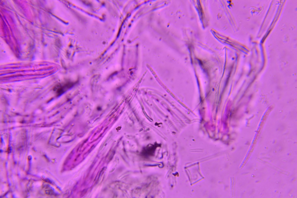 Lophodermium schweinitzii image