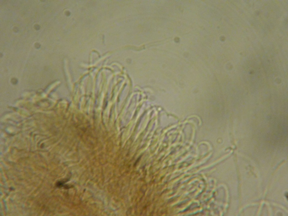 Unguiculariopsis parasitica image