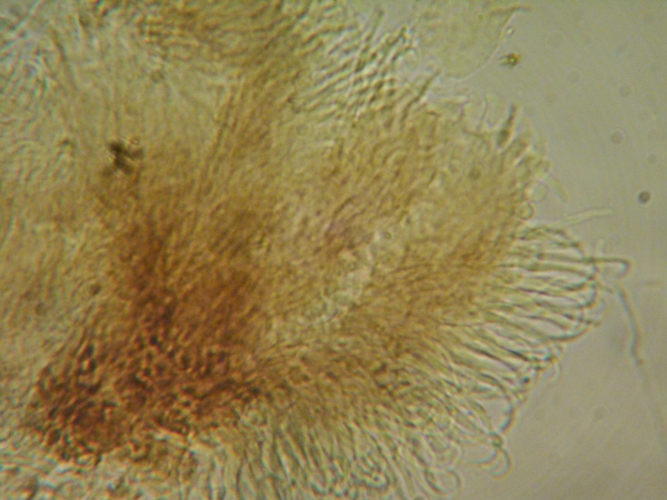 Unguiculariopsis parasitica image