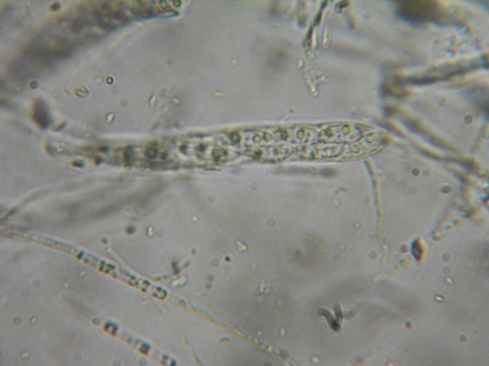 Dencoeliopsis johnstonii image