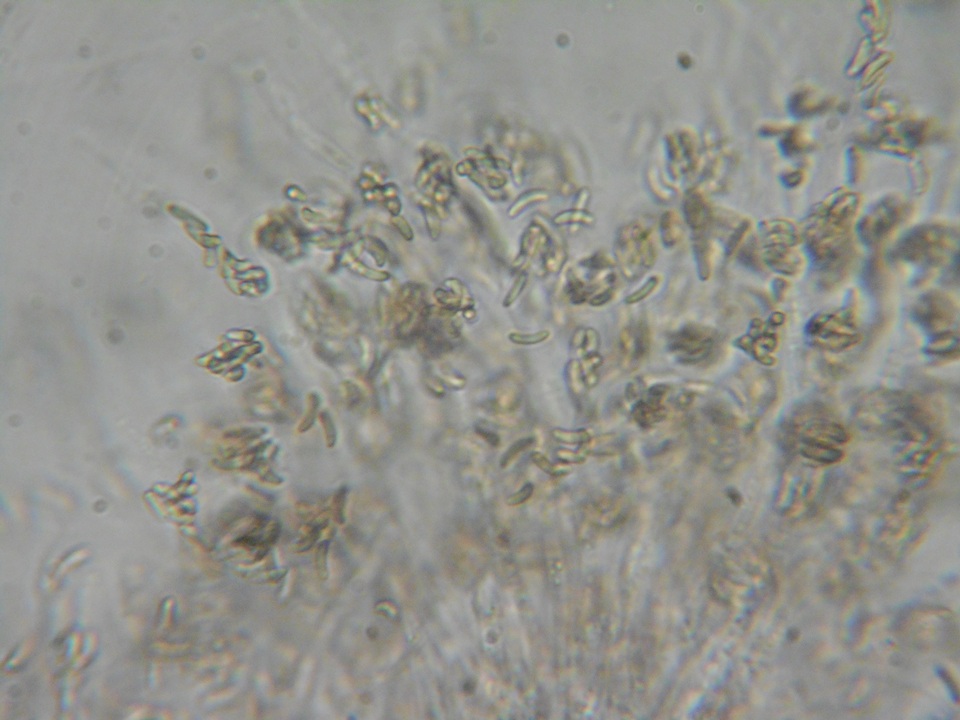 Eutypa flavovirens image