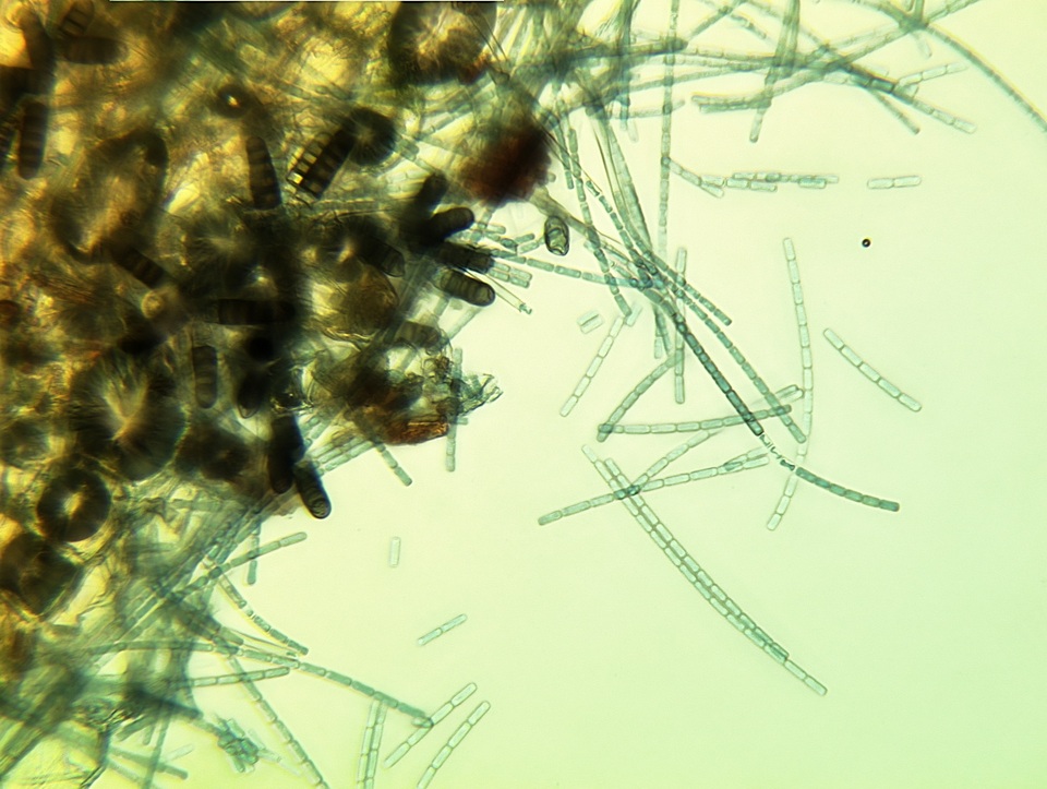 Thielaviopsis basicola image