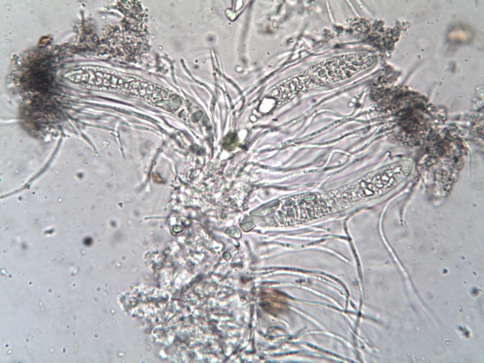 Phlyctis agelaea image