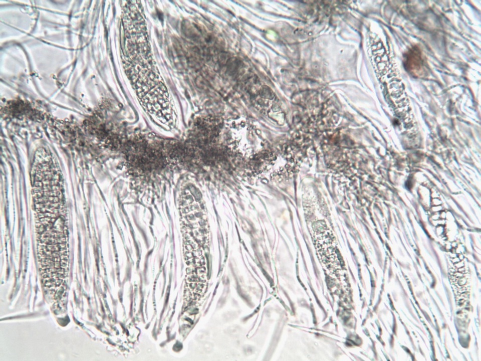 Phlyctis agelaea image