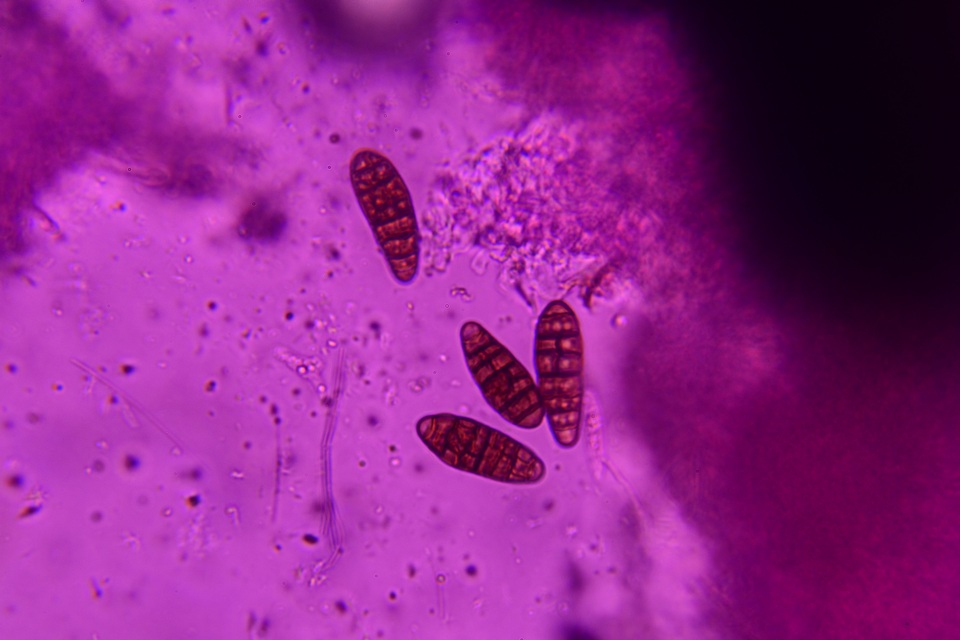 Gloniopsis subrugosa image