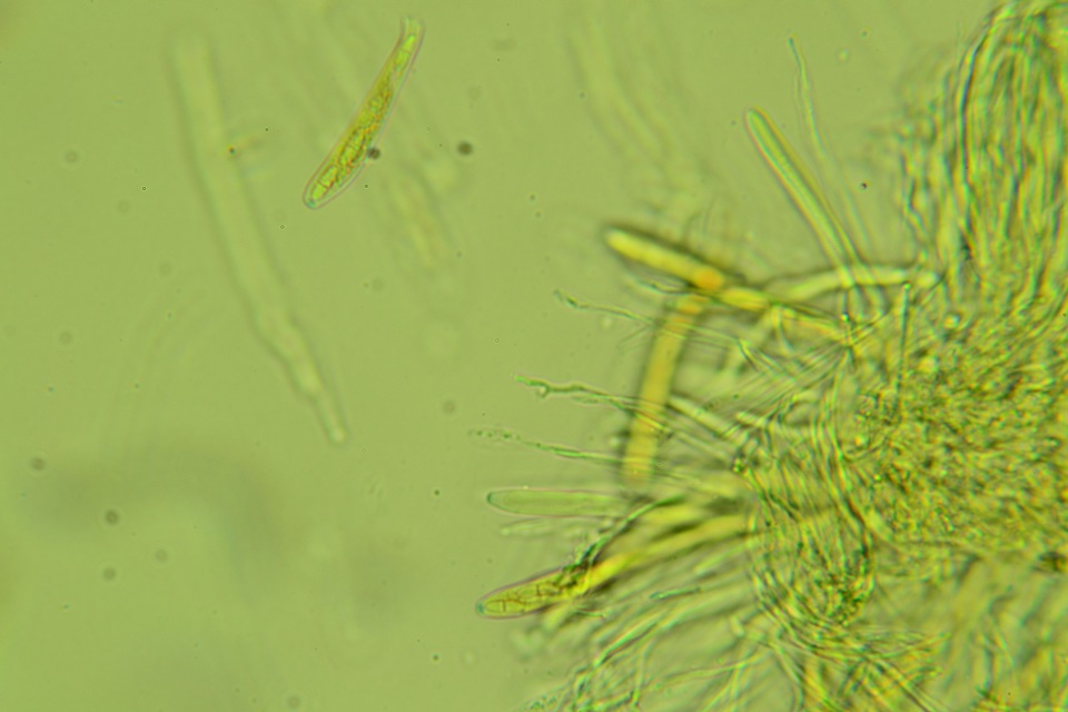 Arachnopeziza trabinelloides image