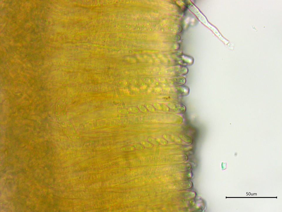 Stromatinia rapulum image