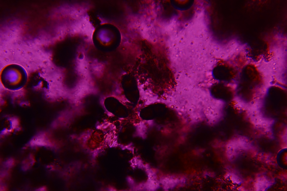 Eutryblidiella hysterina image