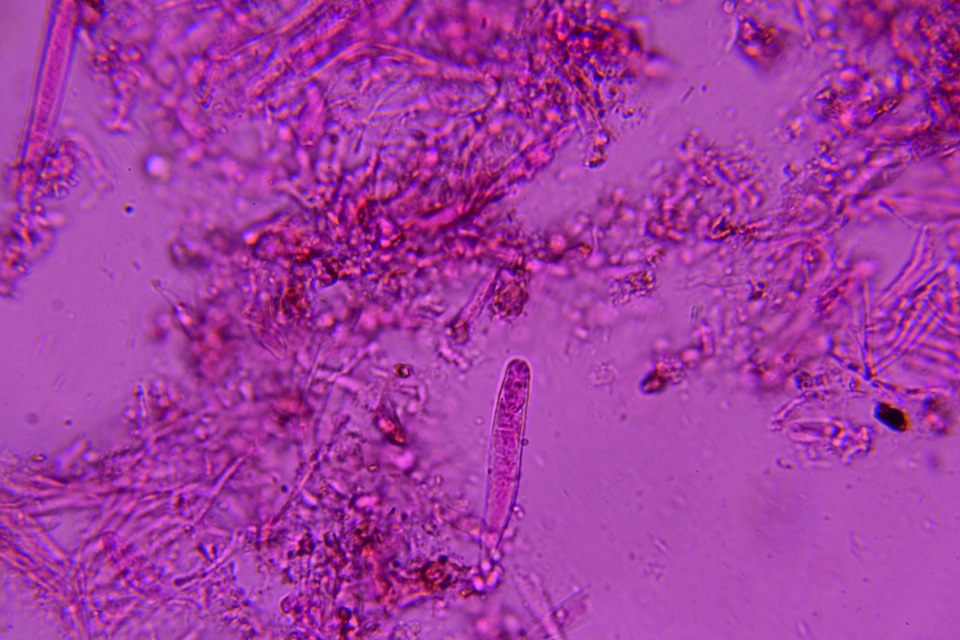 Claussenomyces olivaceus image