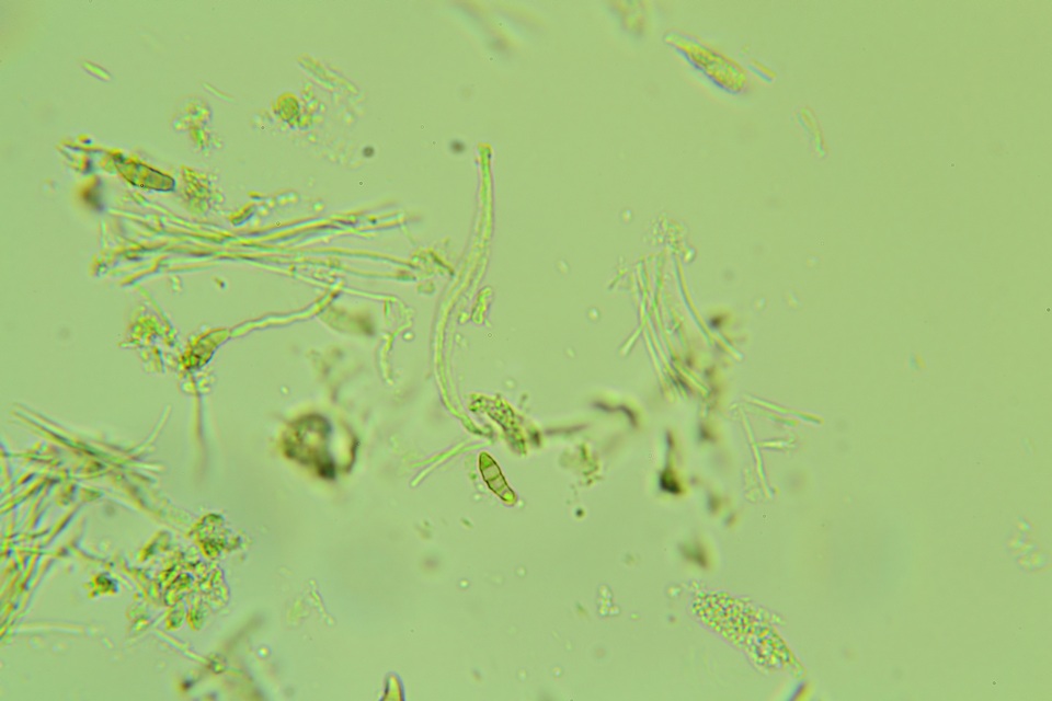 Claussenomyces olivaceus image
