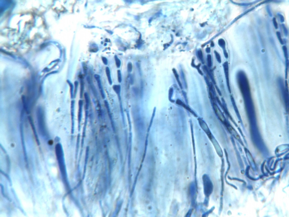 Caloplaca pyracea image