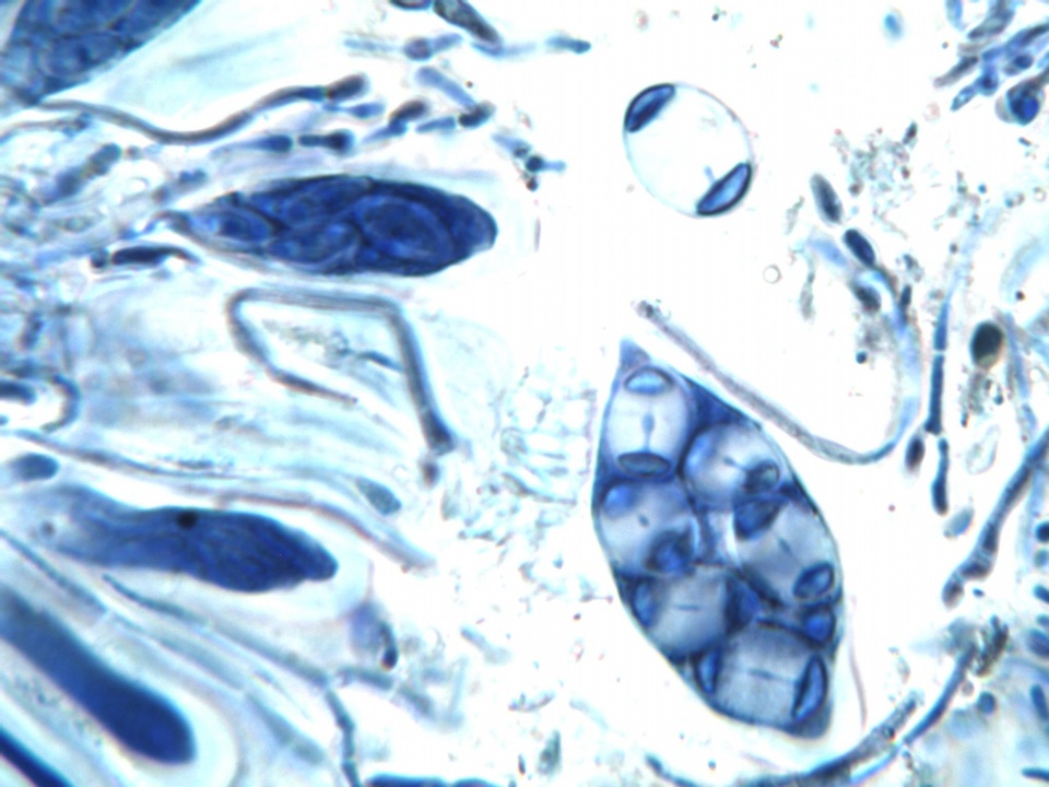 Caloplaca pyracea image