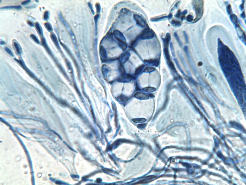 Caloplaca pyracea image