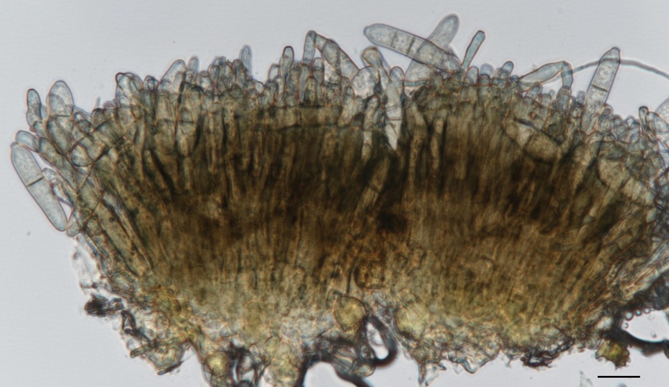 Graminopassalora graminis image