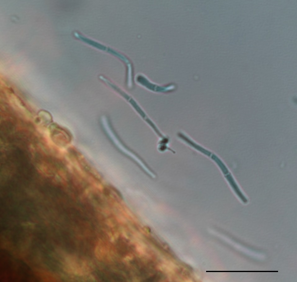 Pseudocercospora kalmiae image