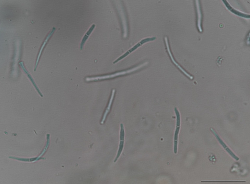 Pseudocercospora kalmiae image