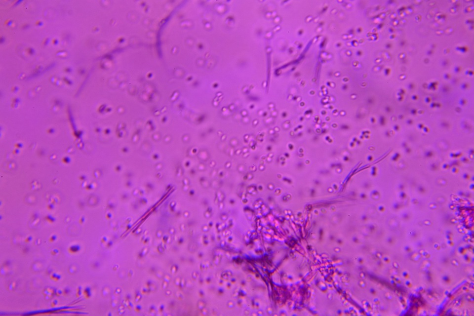Beauveria brongniartii image